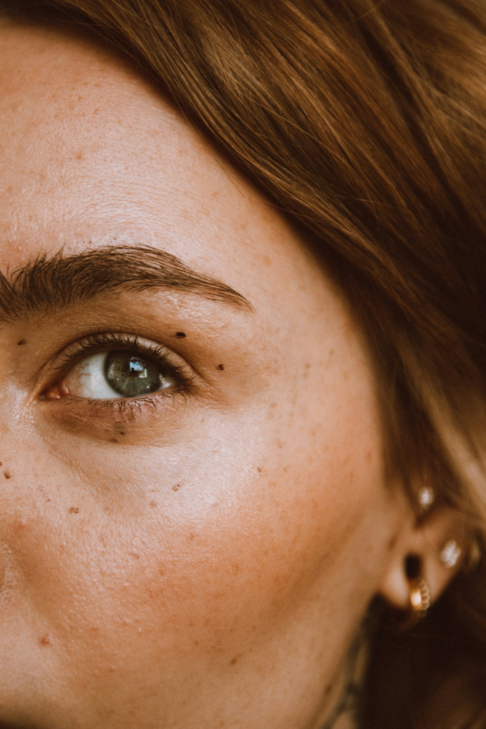 Primer plano de rostro con pigmentación en la piel
