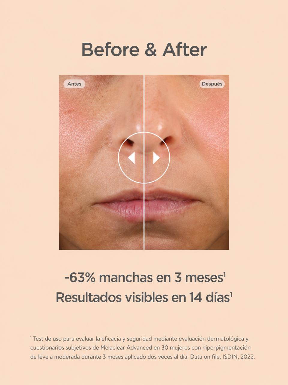 ISDINCEUTICS Melaclear Advance 3%