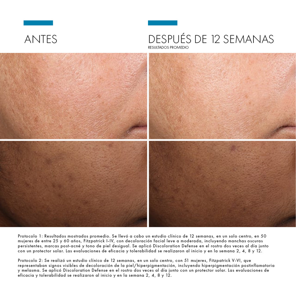 SkinCeuticals Discoloration Defense
