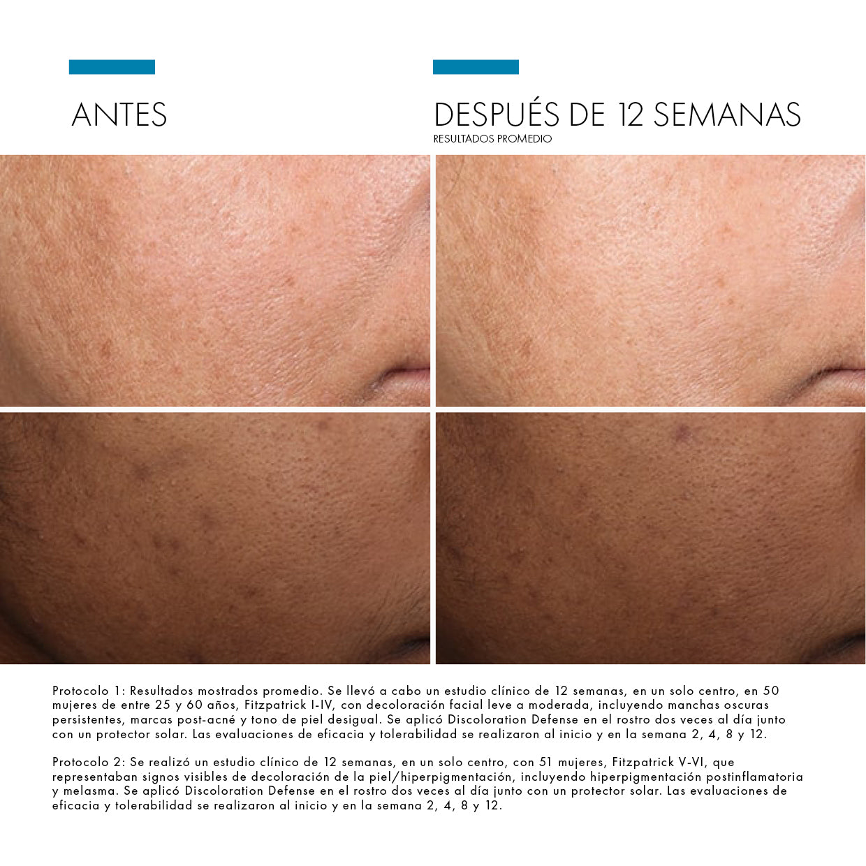SkinCeuticals Discoloration Defense