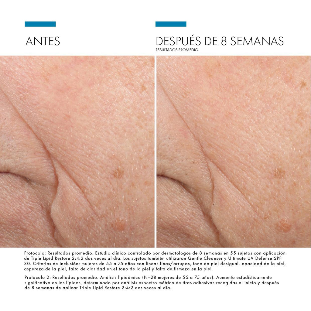 SkinCeuticals Triple Lipid Restore 2:4:2