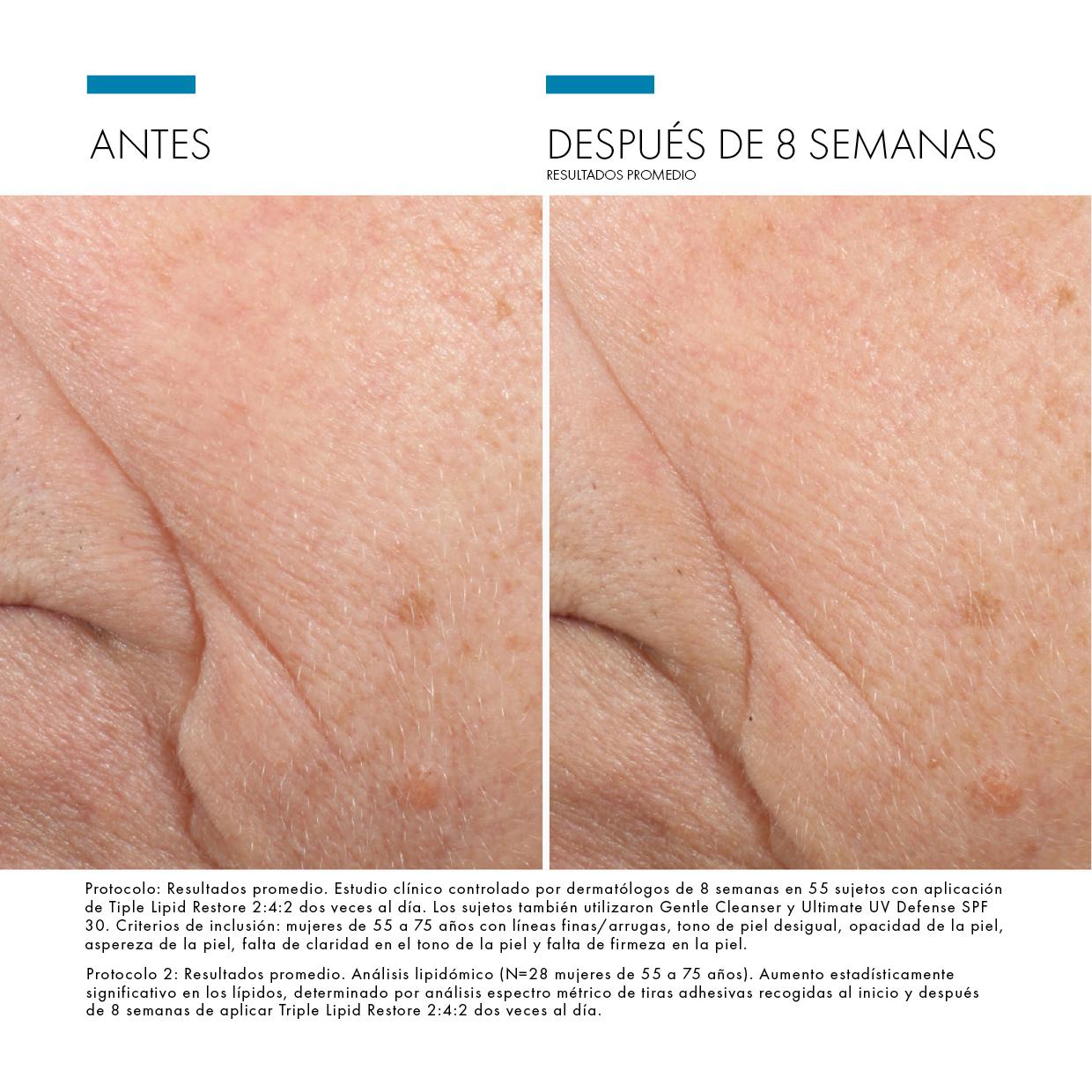 SkinCeuticals Triple Lipid Restore 2:4:2