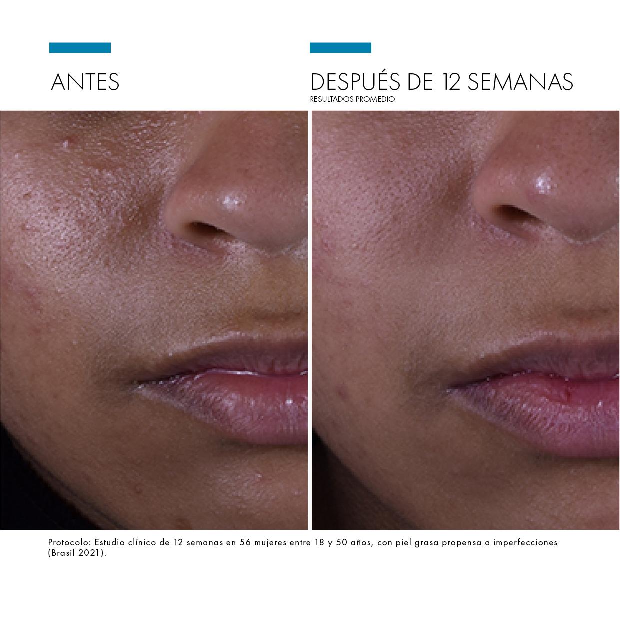 SkinCeuticals Silymarin CF