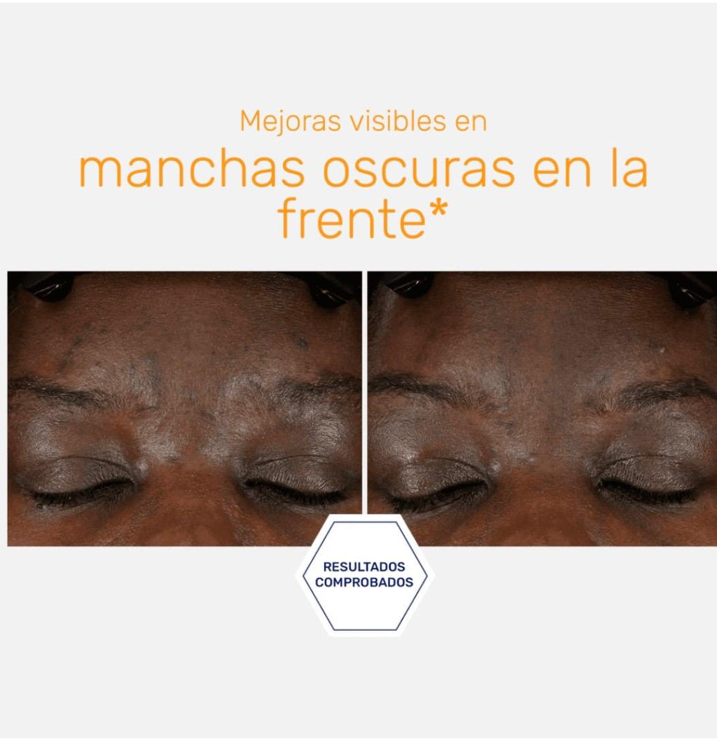 Neostrata Enlighten 15% Vitamina C + PHA